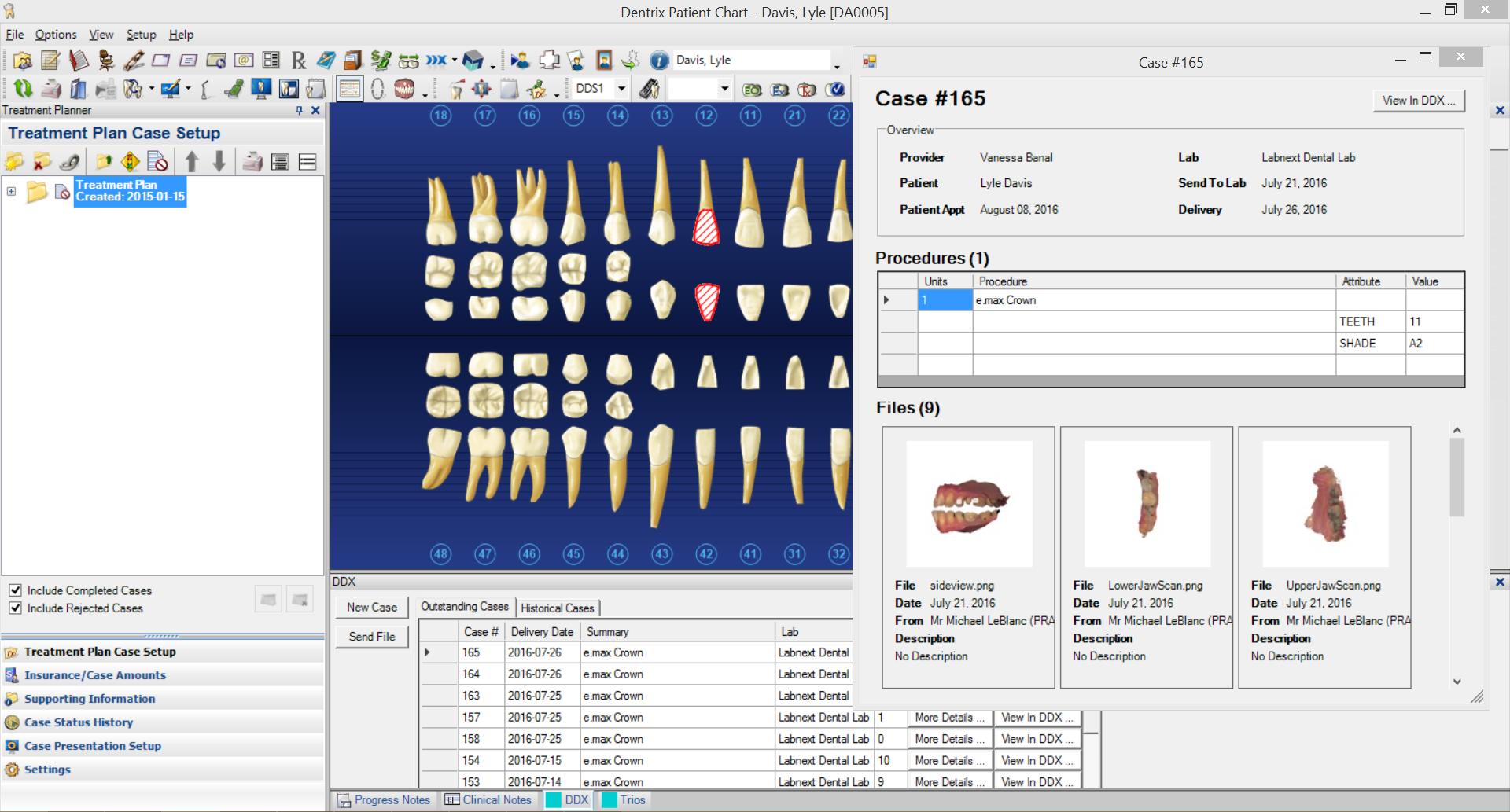 Dentrix Patient Chart