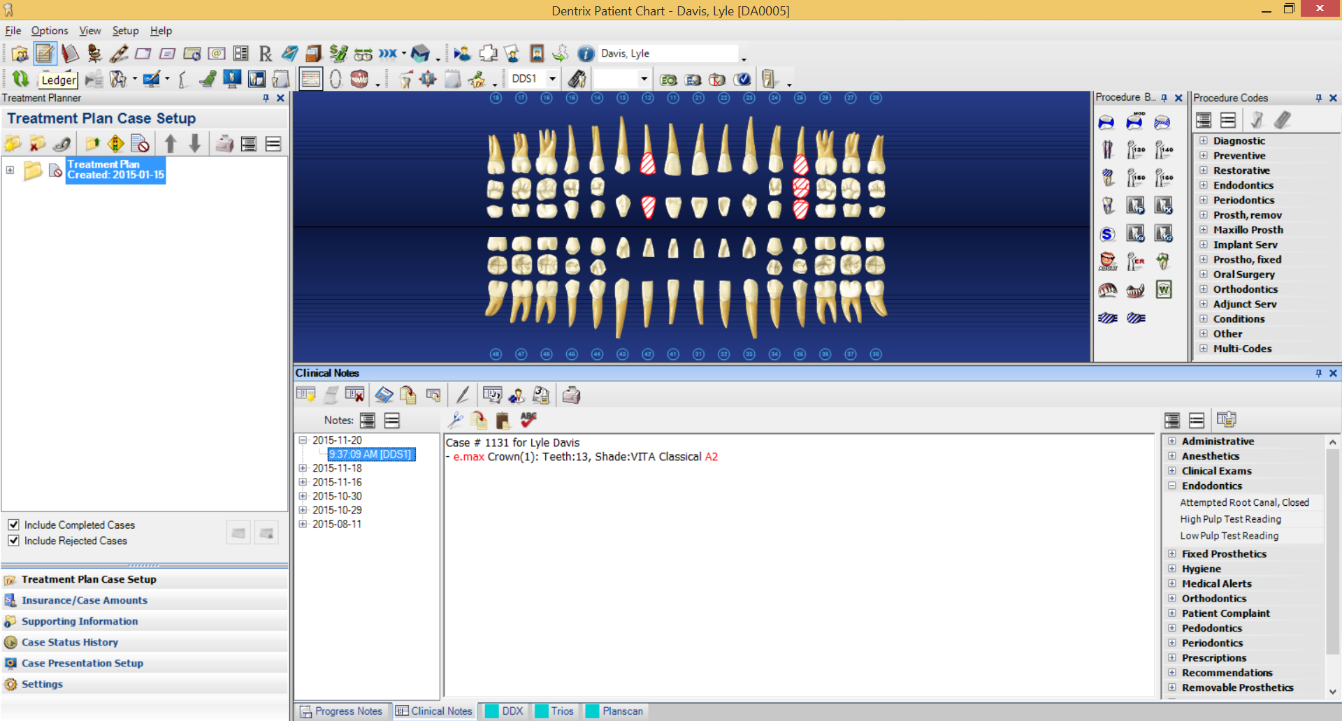 Dentrix Patient Chart