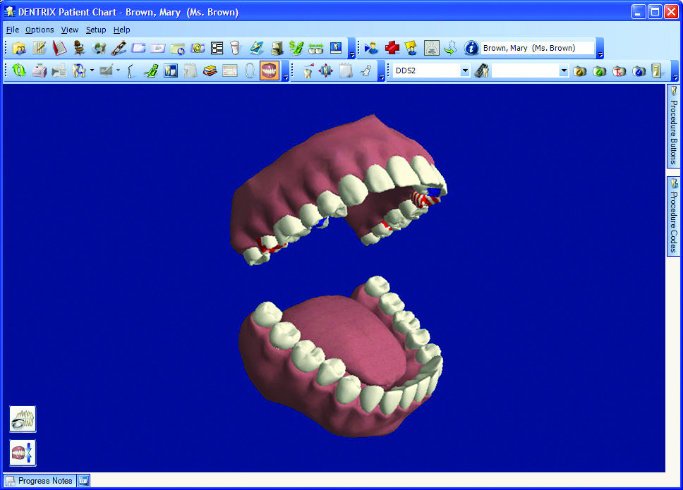 Dentrix Dental Charting