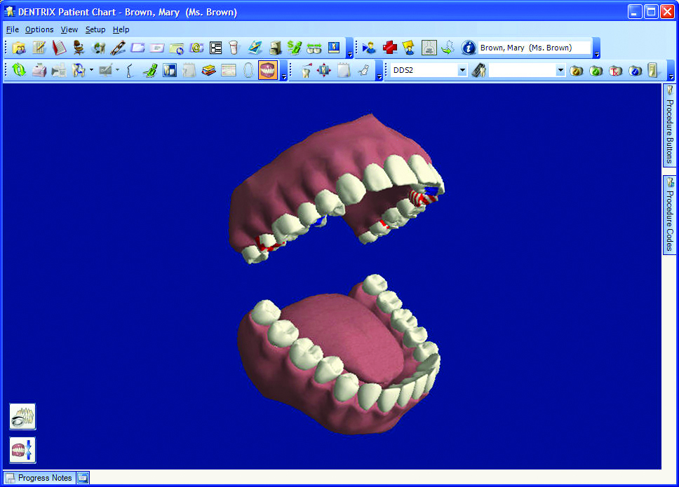 Dentrix Charting