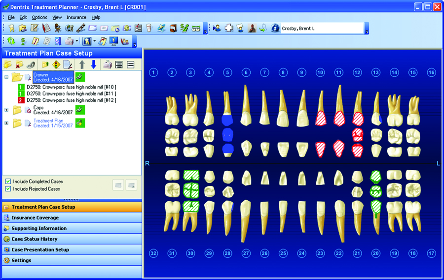 Dentrix Patient Chart