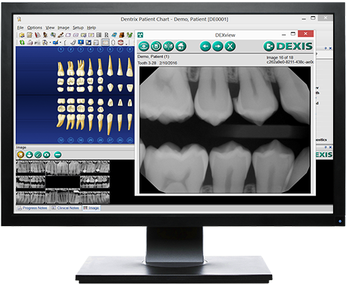 dexis integrator for dentrix